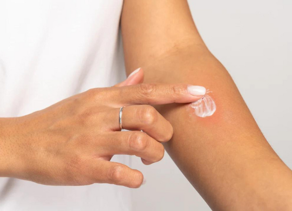 Patch Test: Why Is It Important?