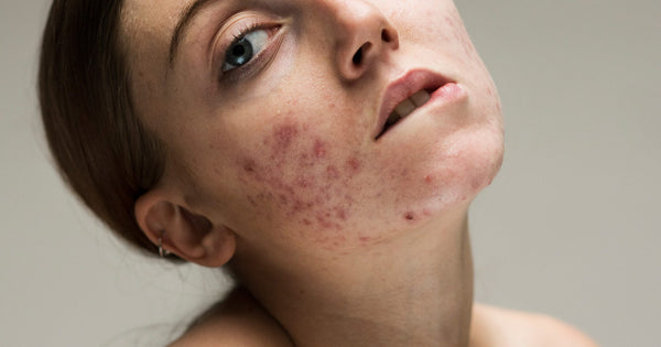 5 most common skin problems and how to address them