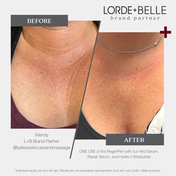 REPAIR SERUM + WRINKLE REDUCING BOOSTER BUNDLE