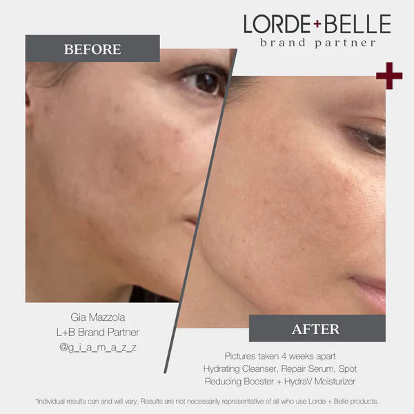 REPAIR SERUM + SPOT REDUCING BOOSTER BUNDLE